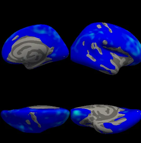 Four views of the right hemisphere’s inflated surface, blue over most of the cortex